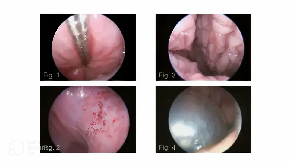 process of transcervical insemination in dogs