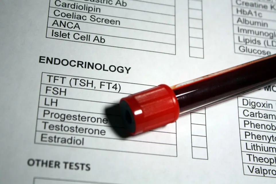 dog progesterone testing