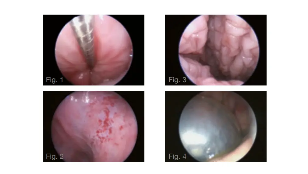 Dog Transcervical Insemination